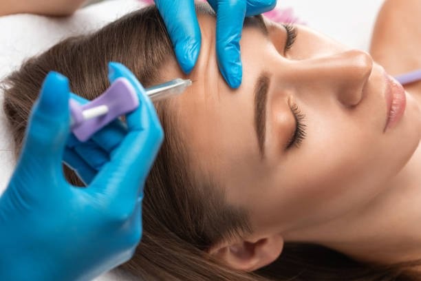 Can PRF Hair Therapy Offer a Permanent Solution to Hair Loss?