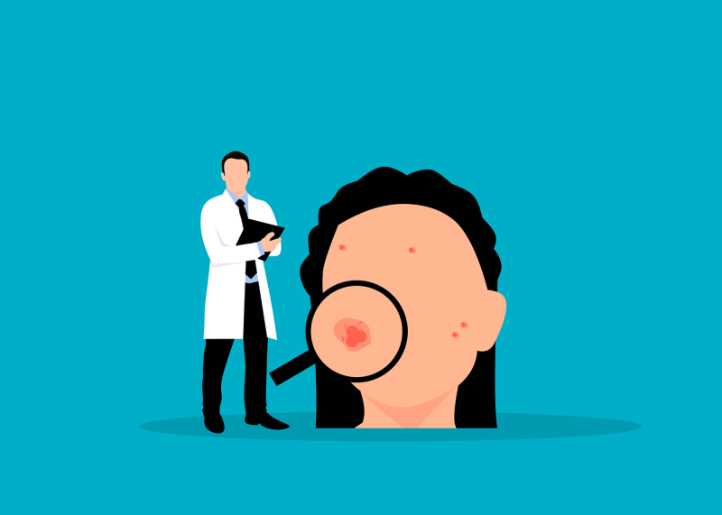 Struggling with Hormonal Acne? Here’s How Facials Can Help
